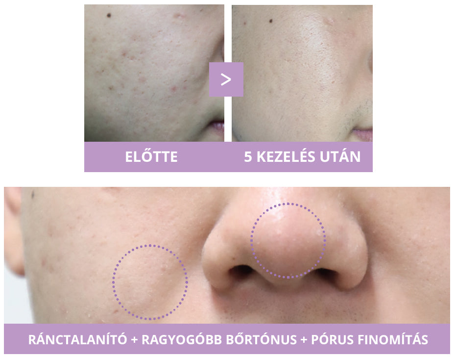 Dr.SPE-CURE Professional programra